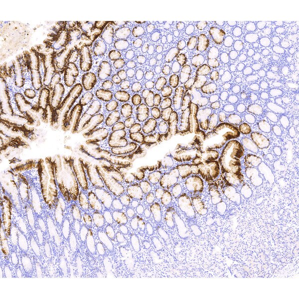 Cytokeratin 20 (CK20)